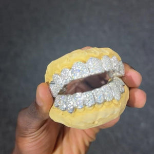 Diamond Dazzle 10/10 Full Set Grillz - Water ATL