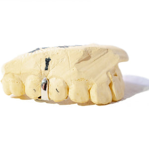 Single Tooth Separator Grillz