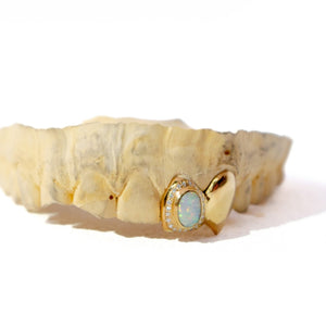 Opal Frost Diamond Grillz