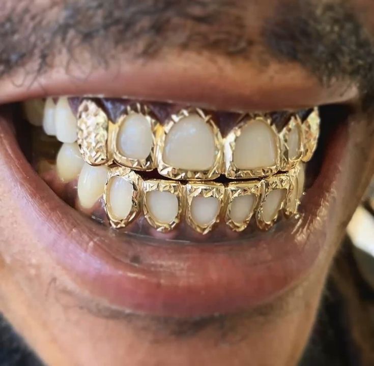 Starburst Cut Open Face Grillz - Water ATL